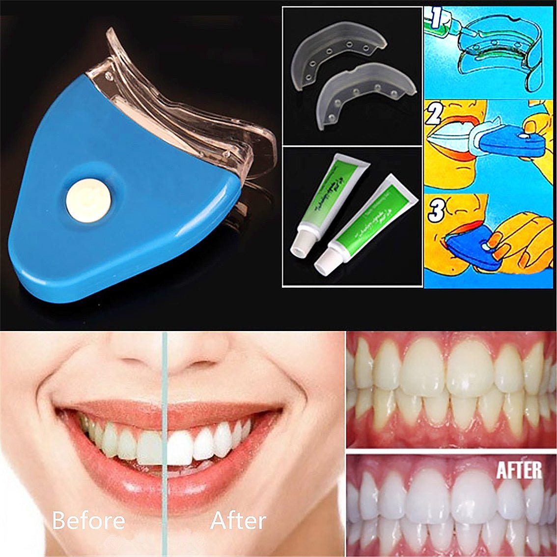 Oral Gel Teeth Tooth Whitening Whitener Dental Bleaching LED - 9 Boss Studio Mp3 store